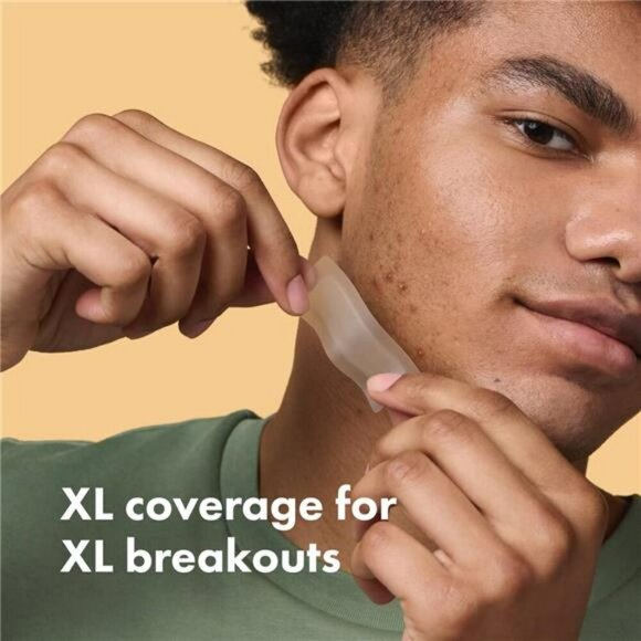 Mighty Patch Surface Acne Pimple Patch for Face Body Chin Forehead 10 Count - Picture 2 of 7